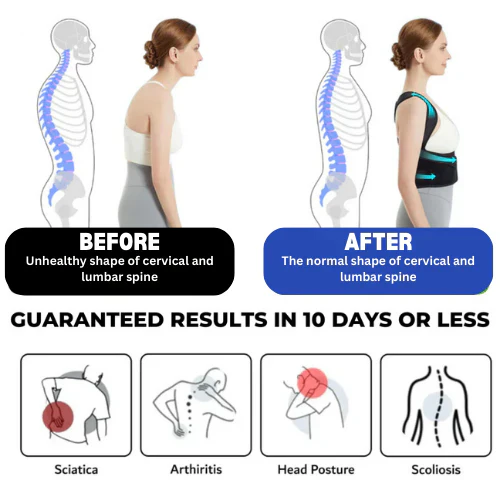 Eicgo™ Adjustable Posture Corrector Belt - Image 2